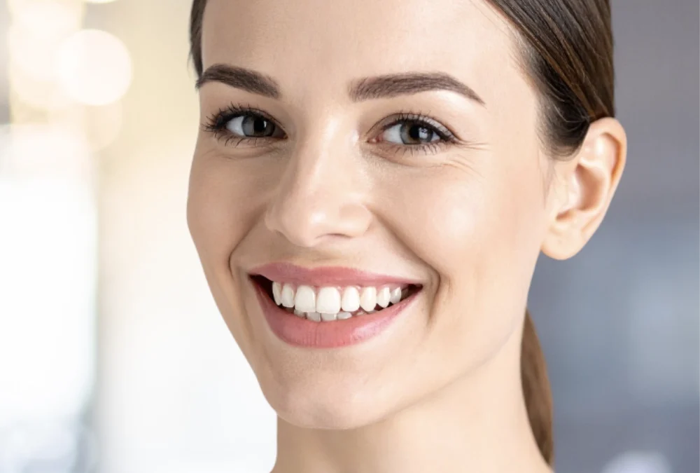 composite veneers for confident smiles